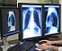 Утверждены новые профессиональные стандарты врача-рентгенолога